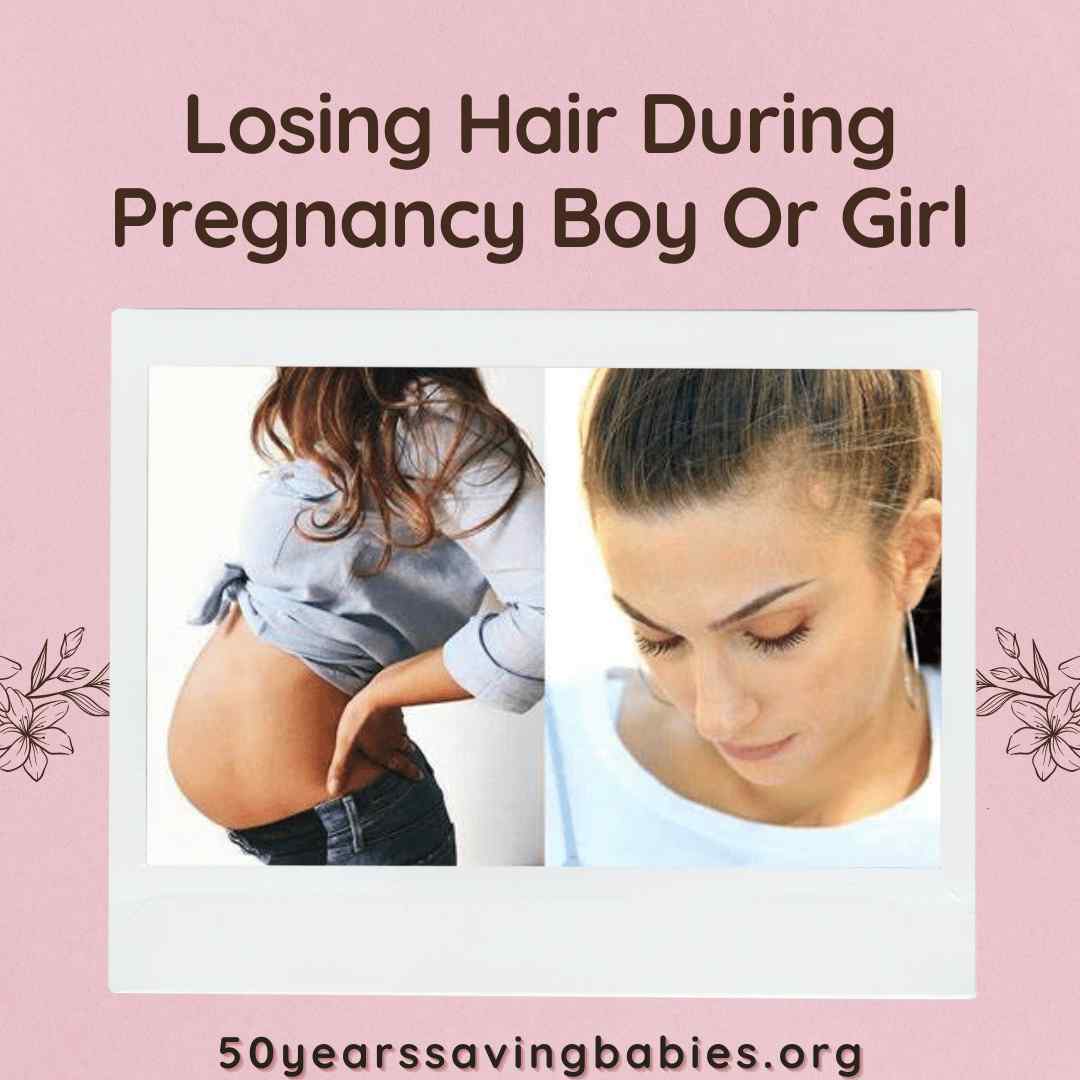 Losing Hair During Pregnancy Boy Or Girl
