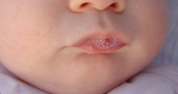 How To Stop A Baby From Spitting Up Mucus